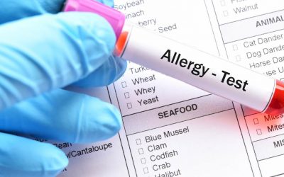 Diagnóstico de alergias alimentarias